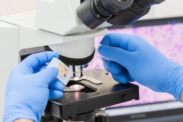 Scientist wear blue glove holding glasses slide and human tissue block, microscope and out of focus computer monitor show glandular image.Medical patholology and cytology laboratory technology concept