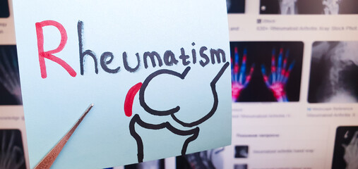 Rheumatism text, note caption. Medical treatment concepts for rheumatism, symptoms, and prevention.