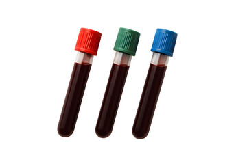 Blood Test Tubes with Colored Caps Transparent PNG