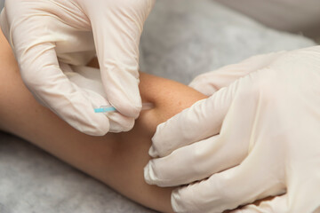 Close-up of a physiotherapist's hands expertly using an ultrasound transducer to treat a patient.