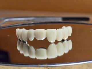 A full set of gleaming dental crowns  is reflected on a shiny surface, showcasing a perfect, bright-white smile.