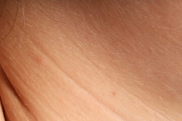 Human skin, closeup view. Detailed texture of surface