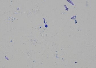 soil microorganisms under a microscope including amoeba, flagellates, nematodes, fungi, bacteria	