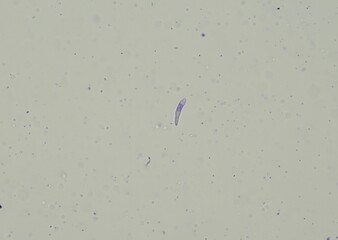 soil microorganisms under a microscope including amoeba, flagellates, nematodes, fungi, bacteria	