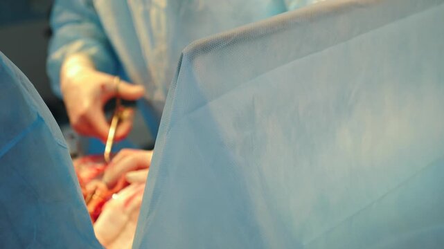 Uterine suture after cesarean section in operating room in modern emergency health care clinic. maternity hospital. Childbirth concept. 4 k video