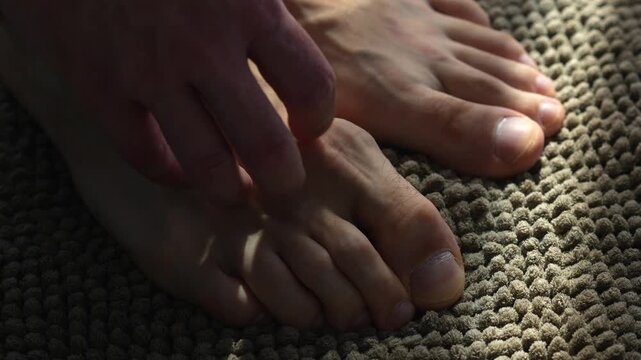 A man scratches his bare foot on a brown carpet in the bathroom after taking a shower.
Foot fungus and itchy skin.
Man scratches his foot with his hand.
Allergy, itching, discomfort, scabies, fungus