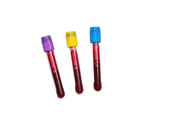 Three pristine medical blood test tubes with dark red liquid and colored caps on a white German lab request form, close-up on plain transparent background, concept of sterile lab testing