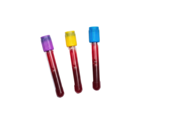Three pristine medical blood test tubes with dark red liquid and colored caps on a white German lab request form, close-up on plain transparent background, concept of sterile lab testing