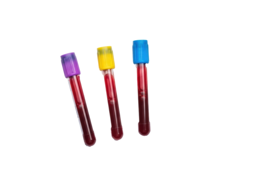 Three pristine medical blood test tubes with dark red liquid and colored caps on a white German lab request form, close-up on plain transparent background, concept of sterile lab testing