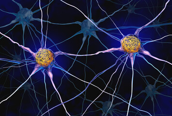 Tau Tangles or Neurofibrillary tangles as Misfolded proteins or Hyperphosphorylation inside the neuron cells resulting in memory loss and brain damage in Alzheimer’s disease as Misfolded proteins.
