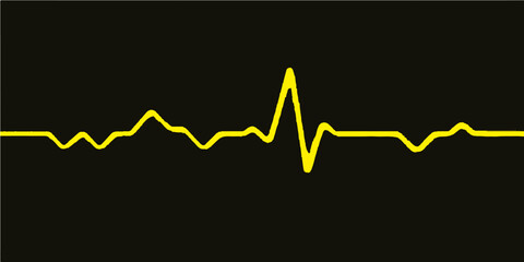 Medical heartbeat cardiogram showing a pulsating green line on a hospital monitor screen, representing a patient's life signs