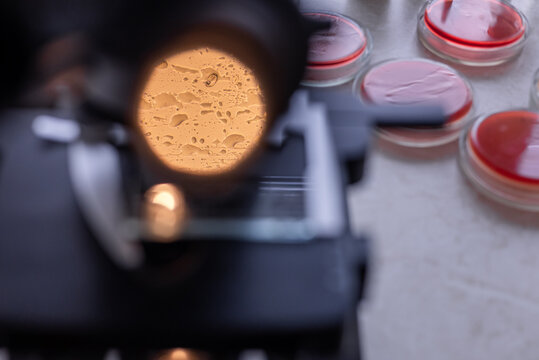 Close up view under the microscope. Close up of worm eggs and bacteria.