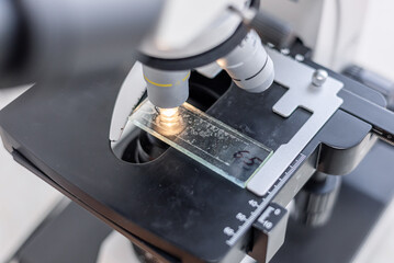 Close up view of laboratory worker using microscope and examines fragments of tissue. Examination under microscope. Test sample under the microscope in laboratory. Microbiology research