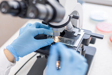 Close up view of laboratory worker using microscope and examines fragments of tissue. Examination under microscope. Test sample under the microscope in laboratory. Microbiology research