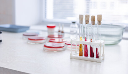 Test tubes and blurred petri dishes in laboratory. Microbiology laboratory yeast cultivation on...