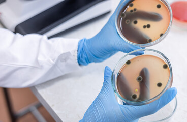 Scientist working with mold and fungal cultures in petri plate in the microbiology lab. Microbiologist working at petri dishes with bacteria, virus and blood samples in the medical research laboratory