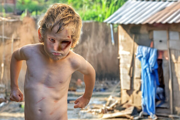 Angry boy in aggressive stance in slum area