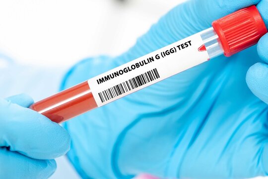 Immunoglobulin G (IgG) Test