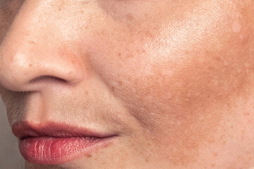 Fototapeta premium Cropped close up photo Woman with pigmentation, melasma, freckles, age spots photo. Texture