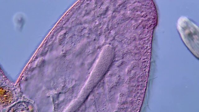 Blepharisma ciliate detail under microscopy view High magnification 