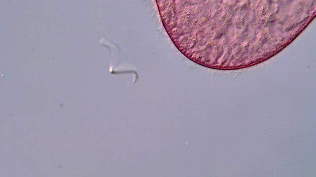 Blepharisma ciliate under microscopy view 400x magnification 