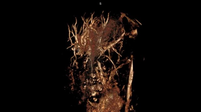 Explore a highly detailed 3D view of the abdomen, highlighting internal organs and anatomical structures. Perfect for medical education, diagnostic imaging, and advanced clinical visualization.