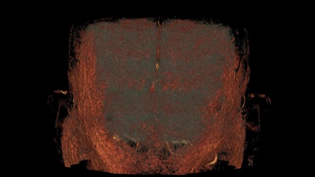 MRA Brain VR Movie showcasing advanced 3D medical imaging of cerebral arteries. High-quality MRI angiography for accurate brain vessel visualization and diagnosis.