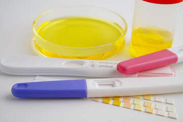 Urinalysis, urine cup with reagent strip pH paper test and comparison chart in laboratory.
