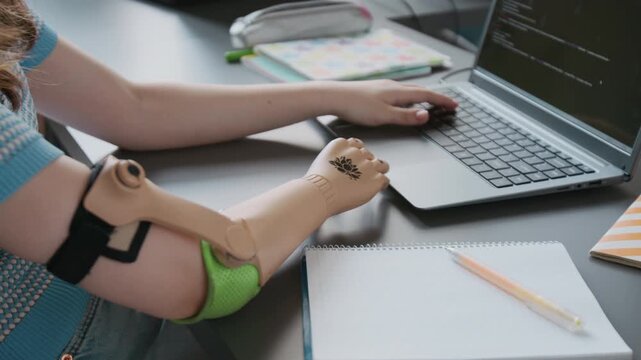 Close-up shot of unrecognizable girl with prosthetic arm typing code on laptop with one hand during programming lesson in school