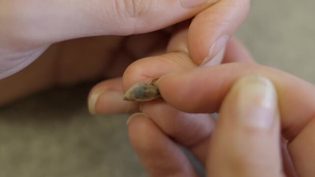 This video shows a close up view of.a hand messing with an injured, bruised, rotten finger nail that is about to fall off.