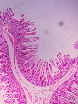 Ileum Histology with Villi and Crypt