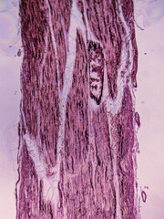 Nerve Fibers: Cross-Section and Longitudinal