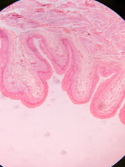 Histology of Normal Bladder Wall under the microscop