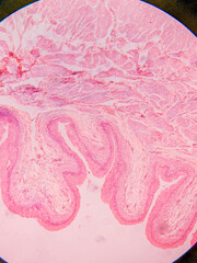 Histology of Normal Bladder Wall under the microscop
