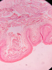 Histology of Normal Bladder Wall under the microscop