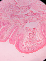 Histology of Normal Bladder Wall under the microscop