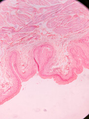 Histology of Normal Bladder Wall under the microscop
