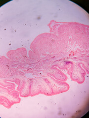 Histology of Normal Bladder Wall under the microscop