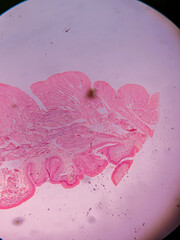 Histology of Normal Bladder Wall under the microscop