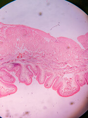 Histology of Normal Bladder Wall under the microscop