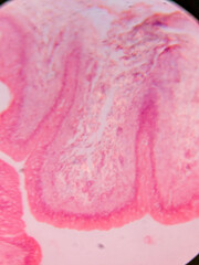 Histology of Normal Bladder Wall under the microscop