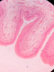 Histology of Normal Bladder Wall under the microscop