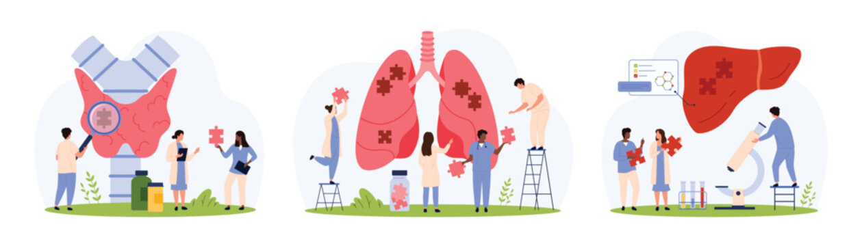 Diagnosis of diseases of internal organs set. Tiny people research with magnifying glass and microscope, connect puzzle pieces in human thyroid gland, liver and lungs cartoon vector illustration
