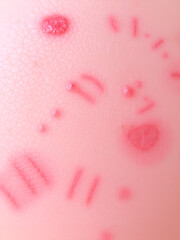 Skin allergy rash dermatitis texture close up background