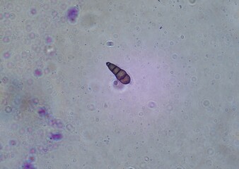 soil microorganisms under a microscope including amoeba, flagellates, nematodes, fungi, bacteria	
