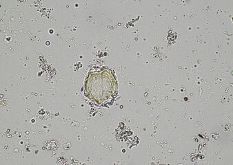 soil microorganisms under a microscope including amoeba, flagellates, nematodes, fungi, bacteria	
