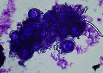 soil microorganisms under a microscope including amoeba, flagellates, nematodes, fungi, bacteria	
