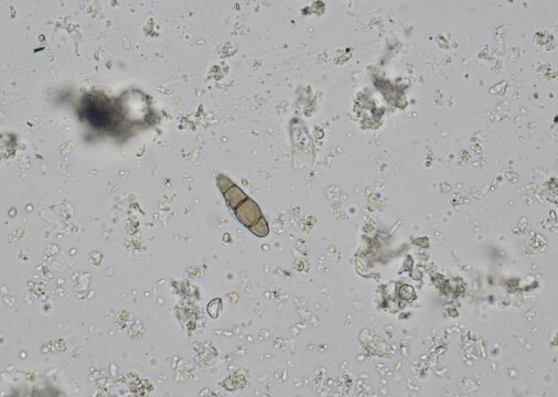 soil microorganisms under a microscope including amoeba, flagellates, nematodes, fungi, bacteria	

