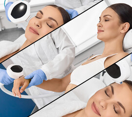 Photorejuvenation procedure with intense pulsed light IPL for photorejuvenation of woman face and body in cosmetology, collage