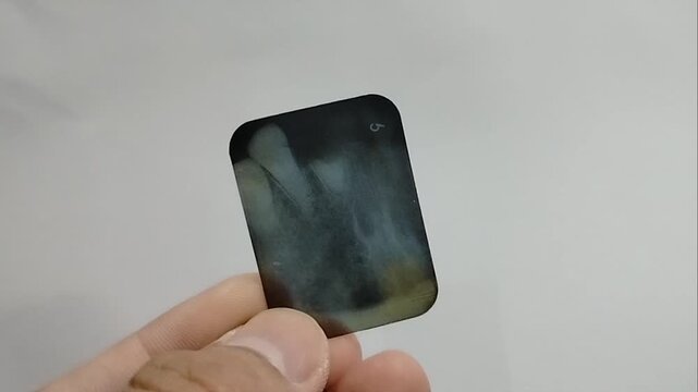 X-ray results of a dental polyclinic patient examined by a doctor.